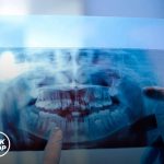 Жителям Калмыкии рассказали, как правильно ухаживать за зубными имплантами